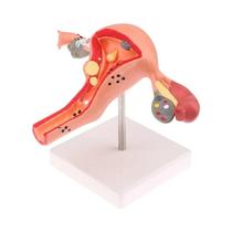 Conjunto De Modelos Anatômicos De Útero E Ovário, Ferramenta De Estudo De Seção Transversal Para Conjunto De Modelos Anatômicos De Útero E Ovário, Ferramenta De Estudo De Seção Transversal Para