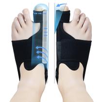 Corretor de joanete MOONSMILE para mulheres e homens Night Splint Corretor de joanete MOONSMILE para mulheres e homens Night Splint