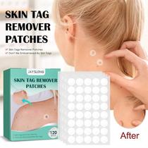 Corretor Imperfeições Pele Verruga Sinal Adesivo Hidrocoloide Skin Tag Remover 36un Prático