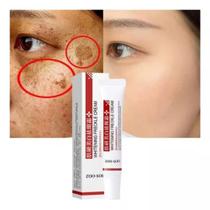 Creme Clareador Melasma Sardas Zoon Son 20g