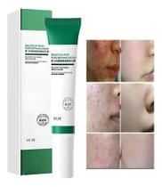 Creme de acido salicílico 20g