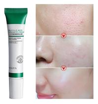 Creme De Ácido Salicílico Para Redução De Poros 20ml