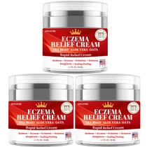 Creme de alívio de eczema APLEFBE para crianças e adultos 50 ml 3 unidades Creme de alívio de eczema APLEFBE para crianças e adultos 50 ml 3 unidades