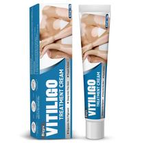 Creme de tratamento de vitiligo Biqyu Improve a pigmentação da pele 20g