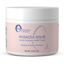 Creme E70 Rosacea Solve - Alívio da Vermelhidão para Pele com Rosácea Creme E70 Rosacea Solve - Alívio da Vermelhidão para Pele com Rosácea