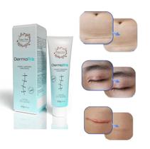 Creme Eficaz Para Cicatriz Regeneração Pele DermaTriz 20g