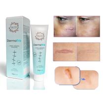 Creme Eficaz Para Cicatrização Regeneração Da Pele 20g DermaTriz