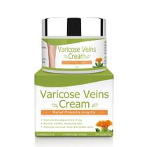 Creme OTBK para Varizes - Alívio para Veias Varicosas