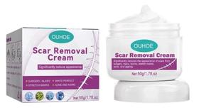 Creme Para Cicatrizes Pretas Remover Feridas Antigas