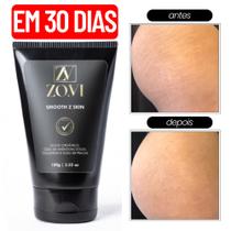 Creme para Estrias e Celulites Hidratação Intensa e Cuidado com a Pele 100g - Smoothzskin