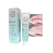 Creme Para Marcas Na Pele 20g DermaTriz A Creme Para Marcas Na Pele 20g DermaTriz A