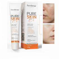 Creme Tratamento Melasma Eficaz 20g