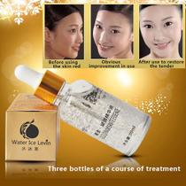 cuidados da cara do creme do alvejante da pele do colagênio do envelhecimento do enrugamento 30ml hialurônico