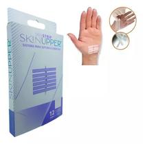 Curativo Ponto Falso Sutura Esteril Cortes Feridas C/12 Un Curativo Ponto Falso Sutura Esteril Cortes Feridas C/12 Un