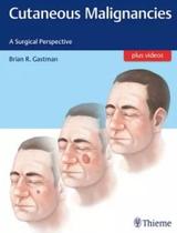 CUTANEOUS MALIGNANCIES, Autor: BRIAN GASTMAN (EDITOR)