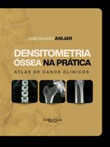 Densitometria ssea Na Prática: Atlas De Casos Clínicos