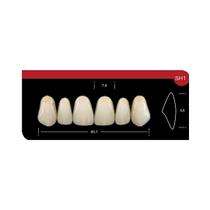 Dente Platinum Tri 03 Camadas Anterior SH1 Superior-Imodonto Dente Platinum Tri 03 Camadas Anterior SH1 Superior-Imodonto