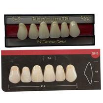 Dente Platinum Tri 03 Camadas Anterior SH3 Superior - Imodonto Dente Platinum Tri 03 Camadas Anterior SH3 Superior - Imodonto