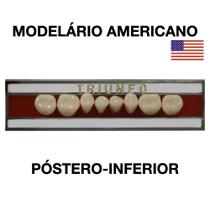Dente Triunfo Posterior Inferior - Triunfo