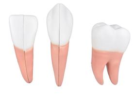 Dentes em 6 Partes (Incisivo, Canino e Molar) - SDORF