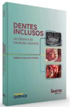 Dentes Inclusos - Um Desafio ao Cirurgião-Dentista - Santos Publicações