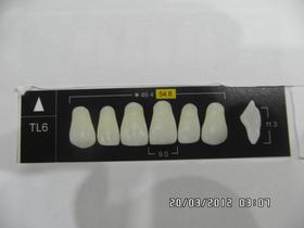 Dentes new ace tl6 s a1 kota