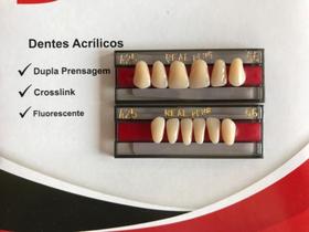 Dentes Resina Postiços Superior E Inferior A25 Dente Triunfo