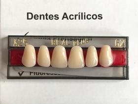 Dentes Resina Restauração Postiços Provisórios A25 Superior 62 - UDB ODONTO