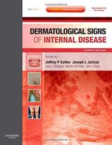 Dermatological Signs Of Internal Disease