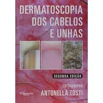 Dermatoscopia dos Cabelos e Unhas Capa dura Dermatoscopia dos Cabelos e Unhas Capa dura