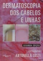 Dermatoscopia dos Cabelos e Unhas Dermatoscopia dos Cabelos e Unhas