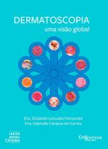 Dermatoscopia Uma Visao Global - Di Livros Editora Ltda Dermatoscopia Uma Visao Global - Di Livros Editora Ltda