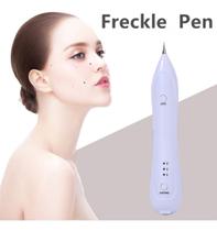 Despigmentador Ultrassônico Analógico Mole Freckle Pen - Lullu Personalizados