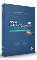 Dicas e Soluções na Implantodontia Prática Clínica - 3ª Edição 2022 - Santos Publicações -