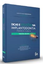 DICAS E SOLUÇÕES NA IMPLANTODONTIA - PRÁTICA CLÍNICA - 3ª EDIÇÃO - Santos Publicações DICAS E SOLUÇÕES NA IMPLANTODONTIA - PRÁTICA CLÍNICA - 3ª EDIÇÃO - Santos Publicações