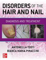 Disorders of the hair and nail: diagnosis and treatment - Mcgraw Hill Education