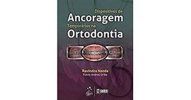 Dispositivos de ancoragem temporarios na ortodontia - Santos Livraria Editora