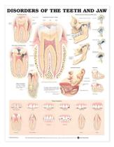 Distúrbios do gráfico anatômico dos dentes e da mandíbula