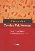 Doenca das celulas falciformes - SARVIER