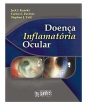 Doenca inflamatoria ocular - SANTOS