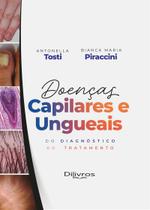 Doenças Capilares E Ungueais: Do Diagnóstico Ao Tratamento Doenças Capilares E Ungueais: Do Diagnóstico Ao Tratamento