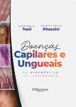 Doenças Capilares e Ungueais do Diagnóstico ao Tratamento - Dilivros