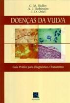 Doenças Da Vulva. Guia Prático Para Diagnostico E Tratamento - Revinter Doenças Da Vulva. Guia Prático Para Diagnostico E Tratamento - Revinter