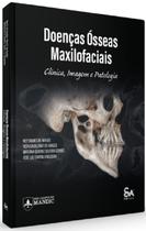 Doenças Ósseas Maxilofaciais Clínica Imagem E Patologia - Santos Publicações Doenças Ósseas Maxilofaciais Clínica Imagem E Patologia - Santos Publicações