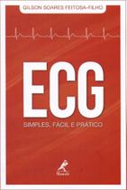 ECG - Simples, Fácil e Prático