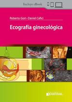 Ecografia ginecologica (espanhol)