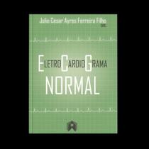 Eletrocardiograma normal Eletrocardiograma normal