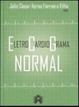 Eletrocardiograma normal