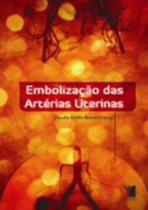 Embolizacao Das Arterias Uterinas - YENDIS