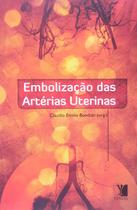 Embolização das Artérias Uterinas - Yendis